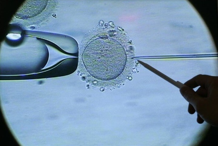 Искусственное оплодотворение яйцеклетки под микроскопом
